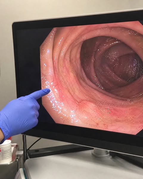 Bloating With No Answers?