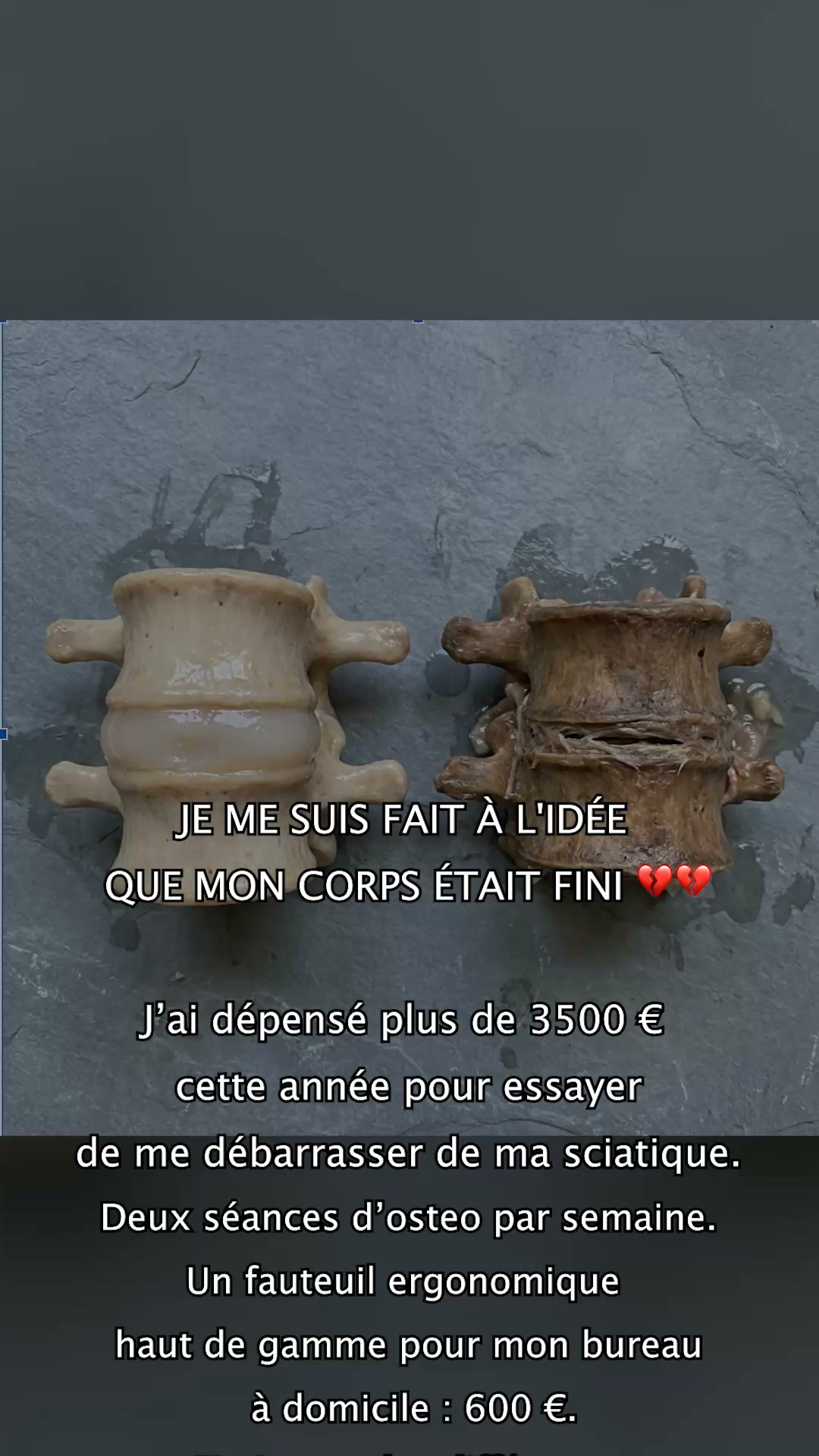 "Adieu" Douleurs chroniques en 7 Jours