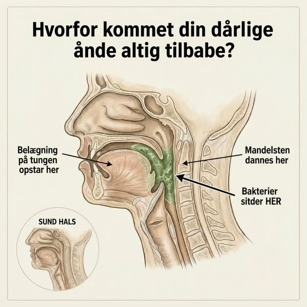 Kæmper du med kronisk dårlig ånde og har gennem årene gennemgået forgæves behandlinger? Her er den eneste løsning