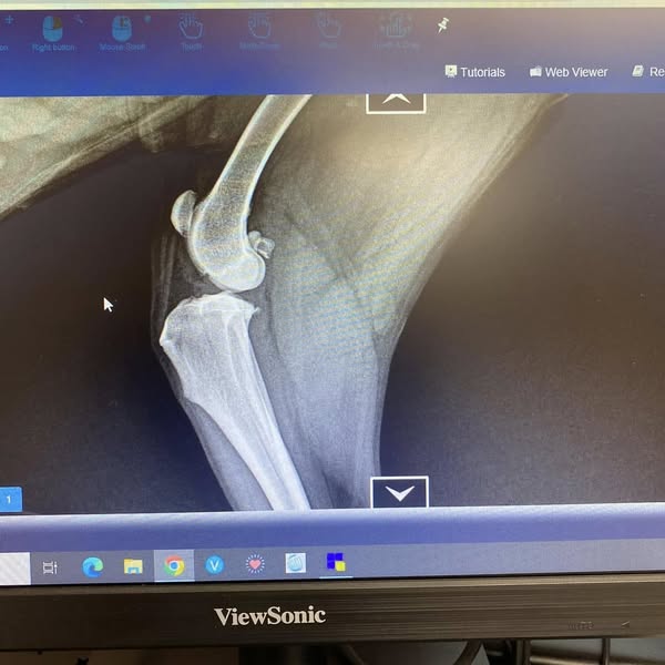 When Surgery Isn’t Within Reach, Support the Steps That Still Matter