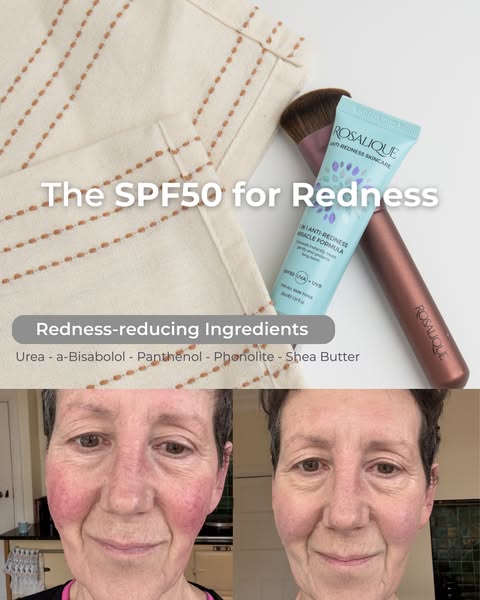SPF50 Protection Designed For Rosacea