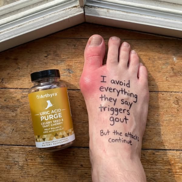 Allopurinol can help stop new uric acid being made — but it does nothing for the crystals already lodged in your joints.