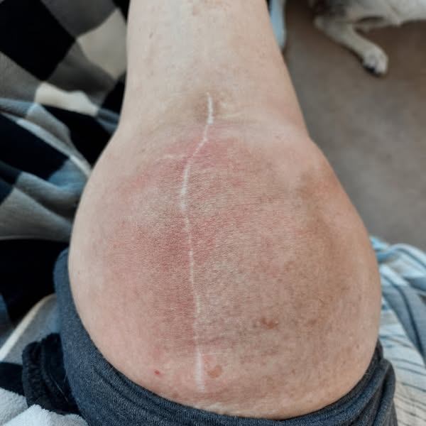 Knee Pain? Read this