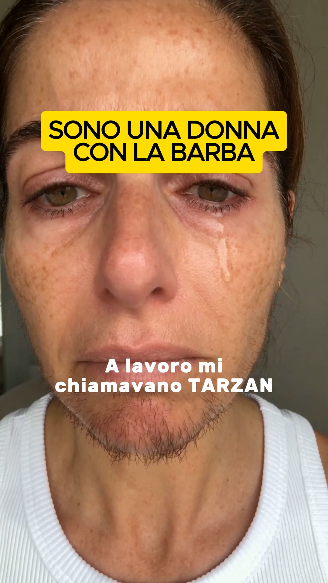Addio peli sul viso