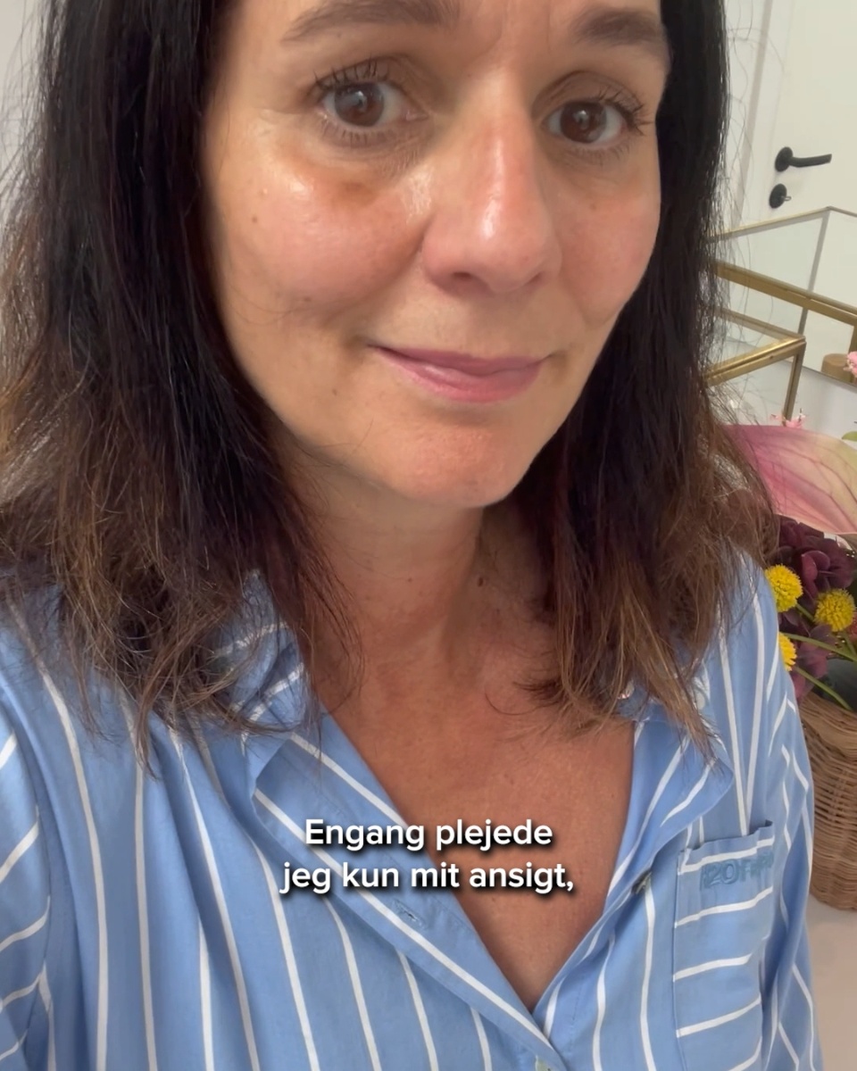 Gør pigmentpletter mindre synlige