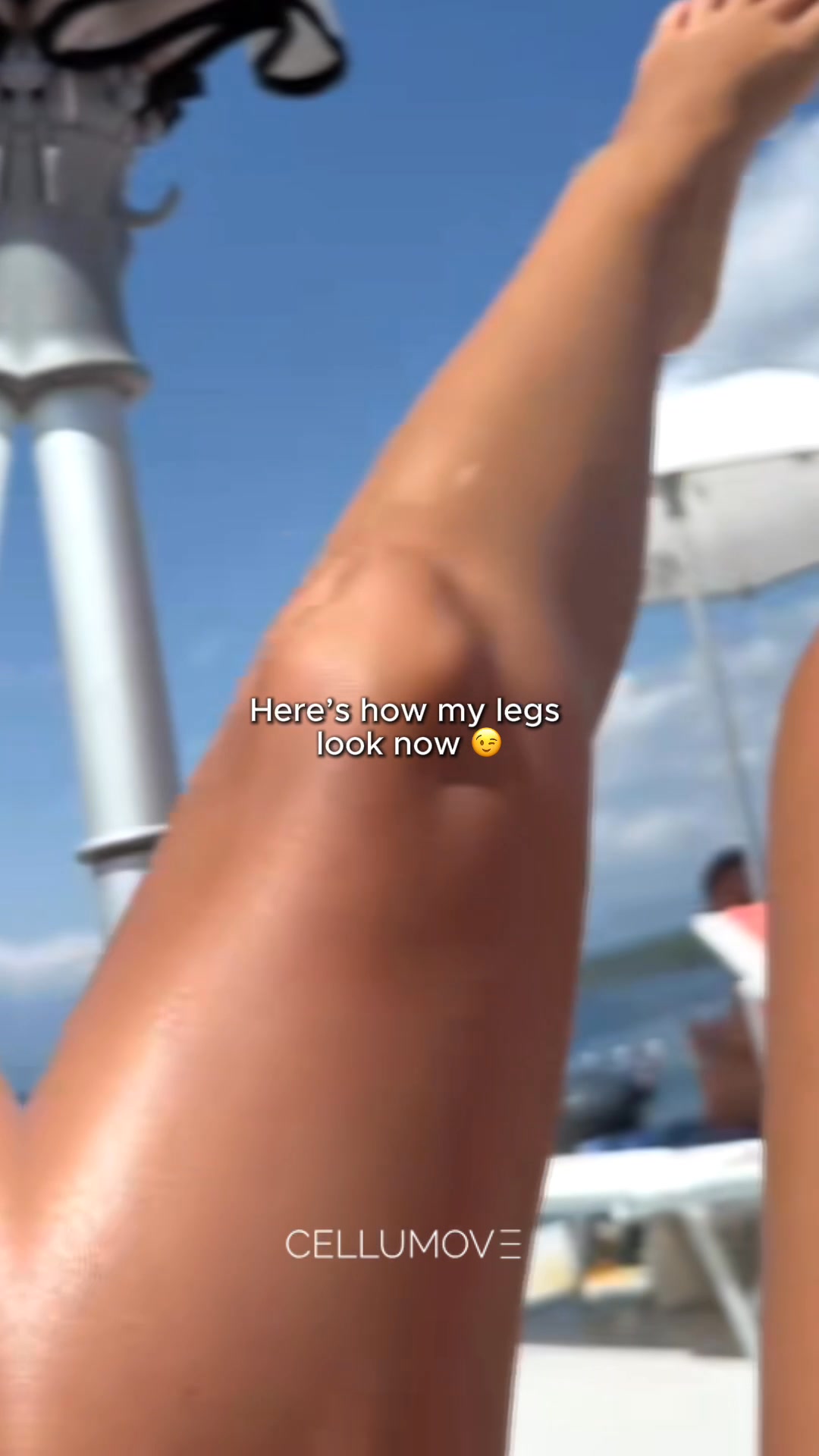 Show Your Legs with Confidence!