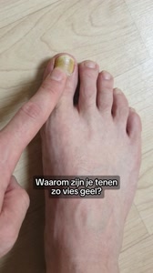 De precieze reden waarom Gezondheidsweek besloot Supplend onder de loep te nemen