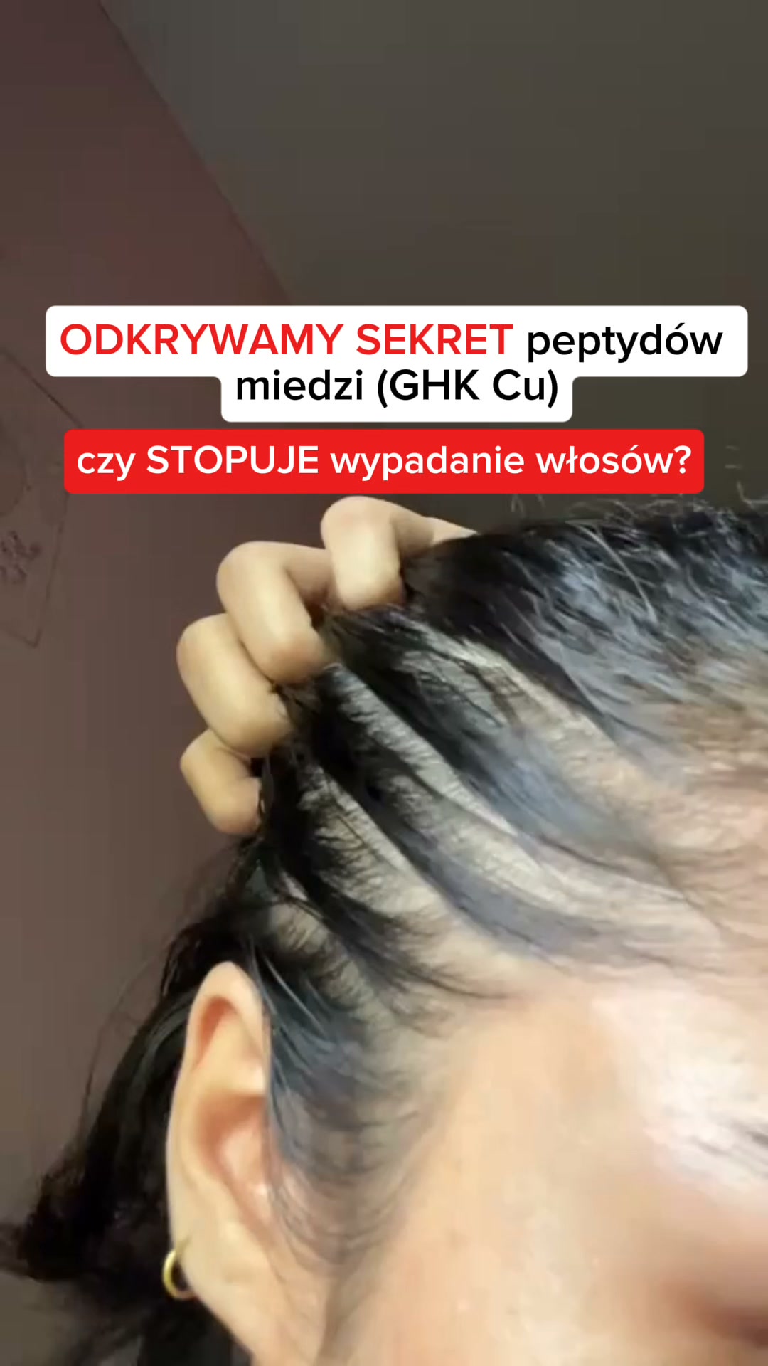 Zatrzymaj Wypadanie. Przywróć Porost.