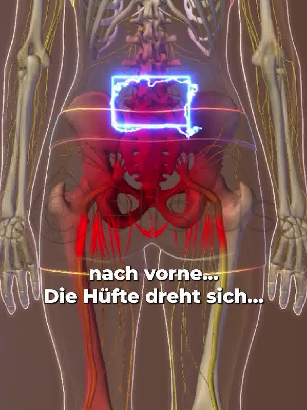 Stoppen Sie Ischias Schmerzen