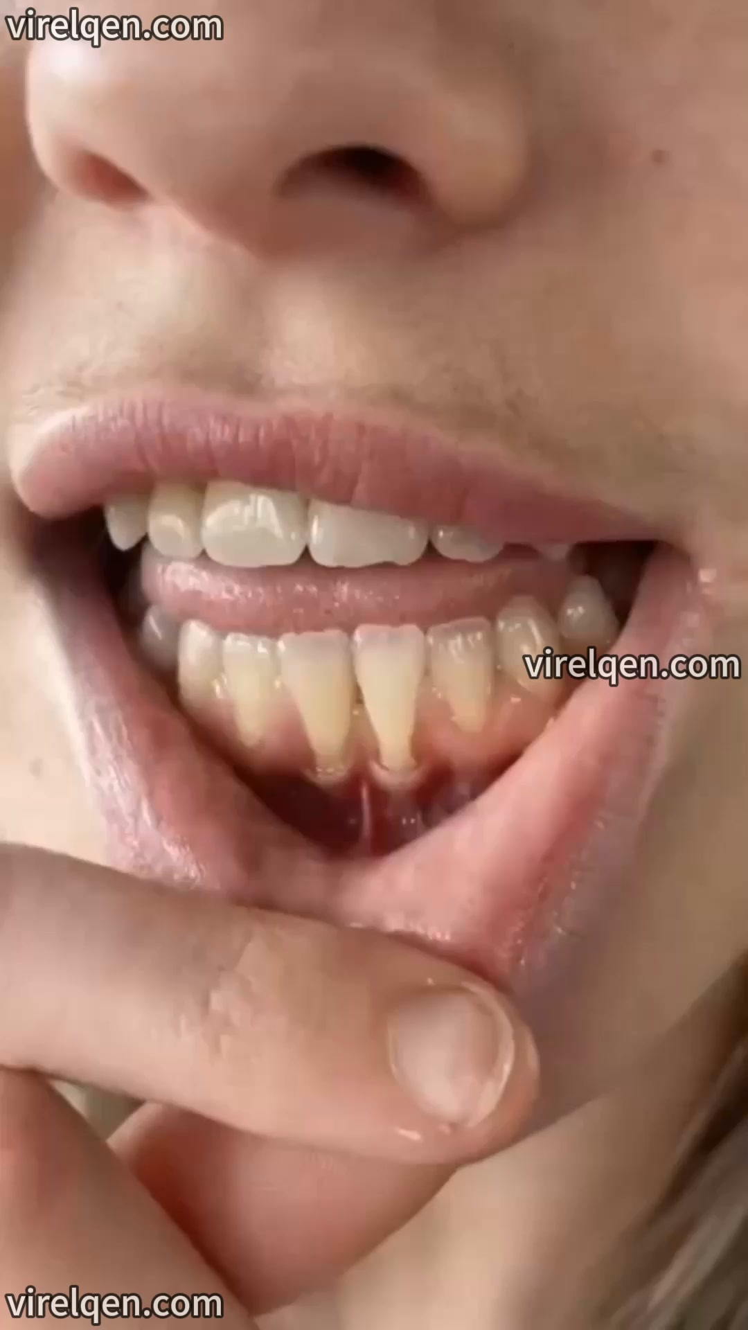 Address loose teeth and fragile gums.