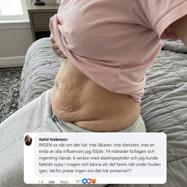 Forskare Hittade Proteinet Som Strammar Lös Hud