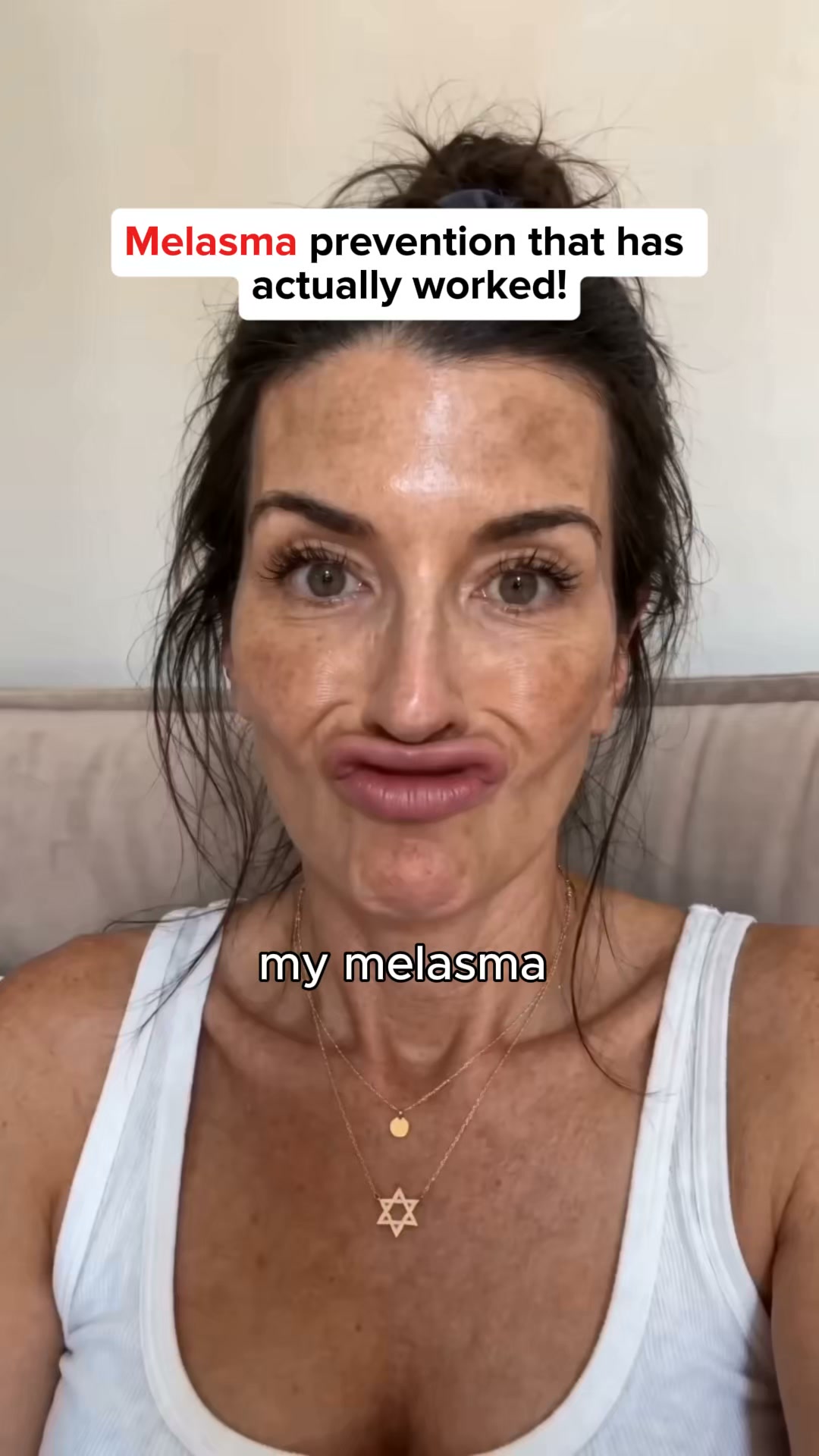 Stop Covering Perimenopause Melasma With Makeup, Do This Instead