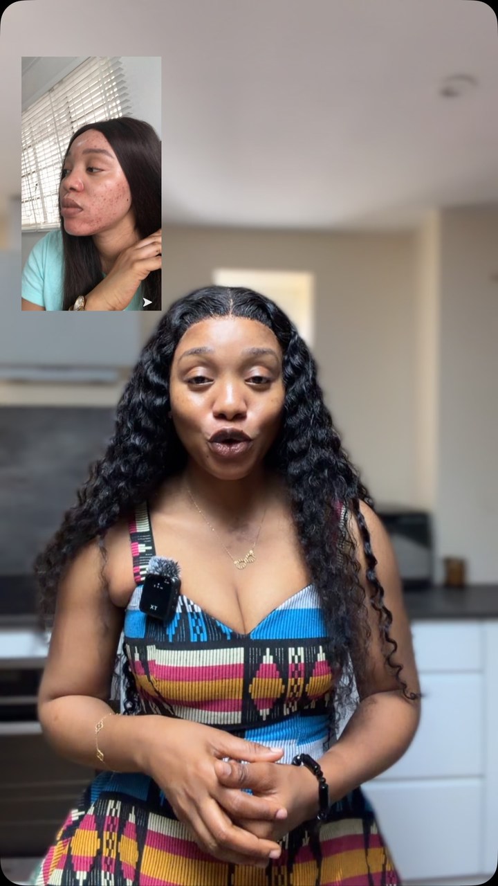 Anúncio de Barbieskincare
