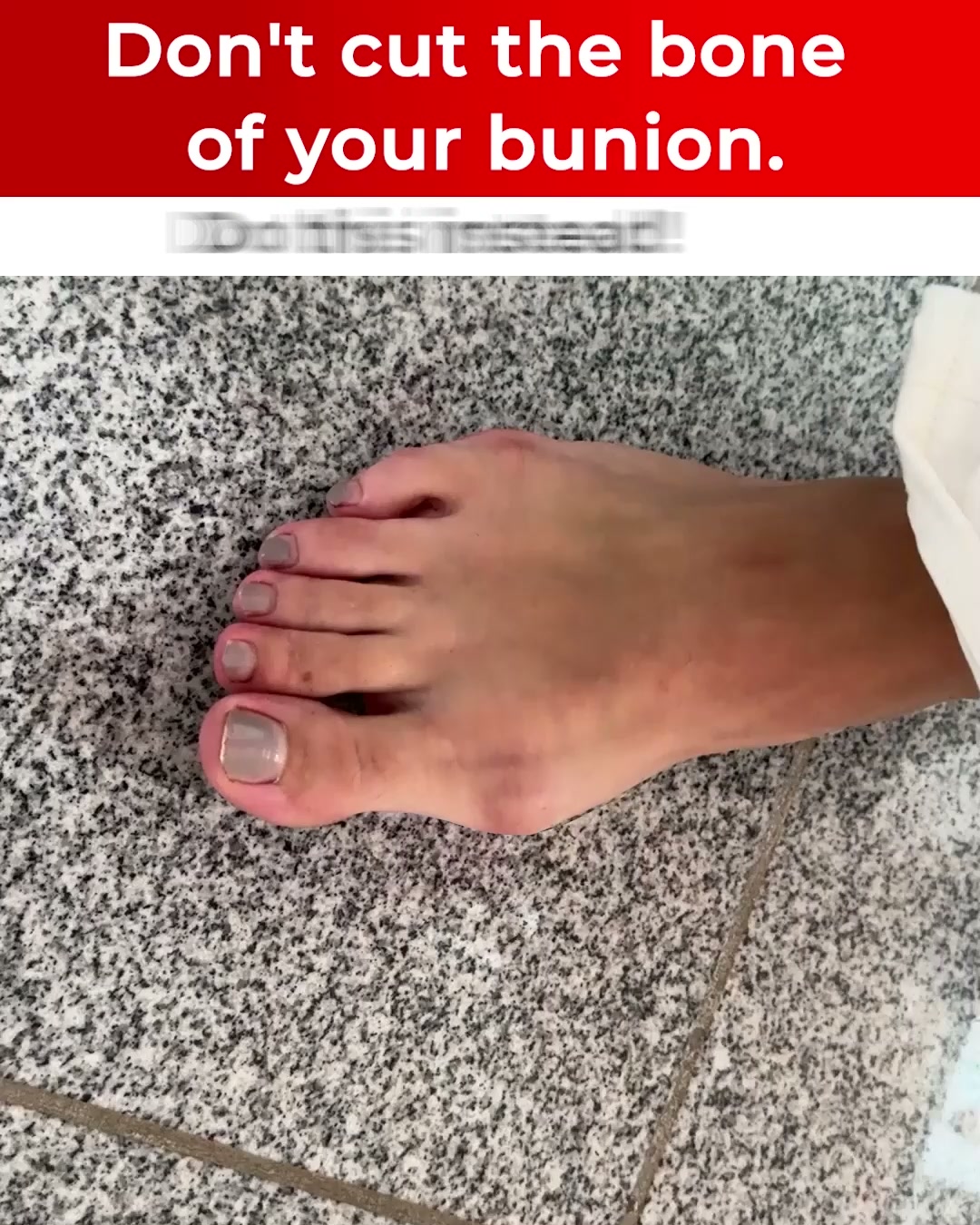 Comfysole 2.0