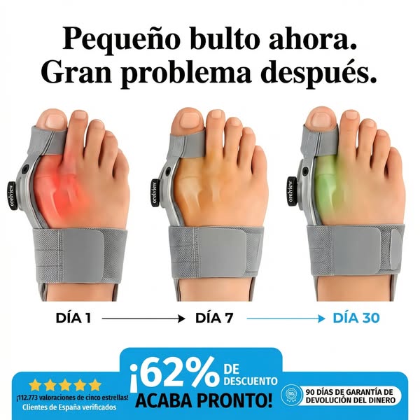 ¡Última llamada para frenar el juanete y ahorrar más del 60%!