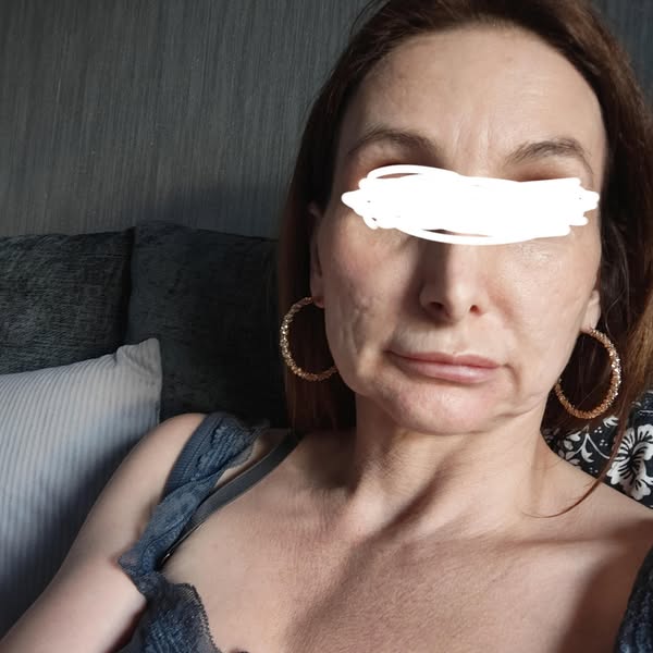 Zeg vaarwel tegen een doffe, vermoeide huid