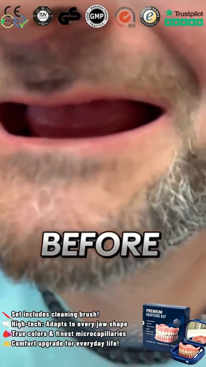 A New Generation Full Denture Solution for a Natural Smile