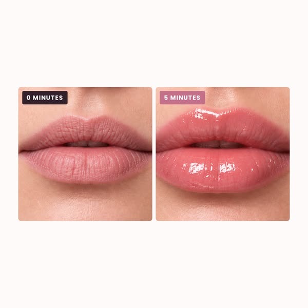 My Lips Came Back to Life!