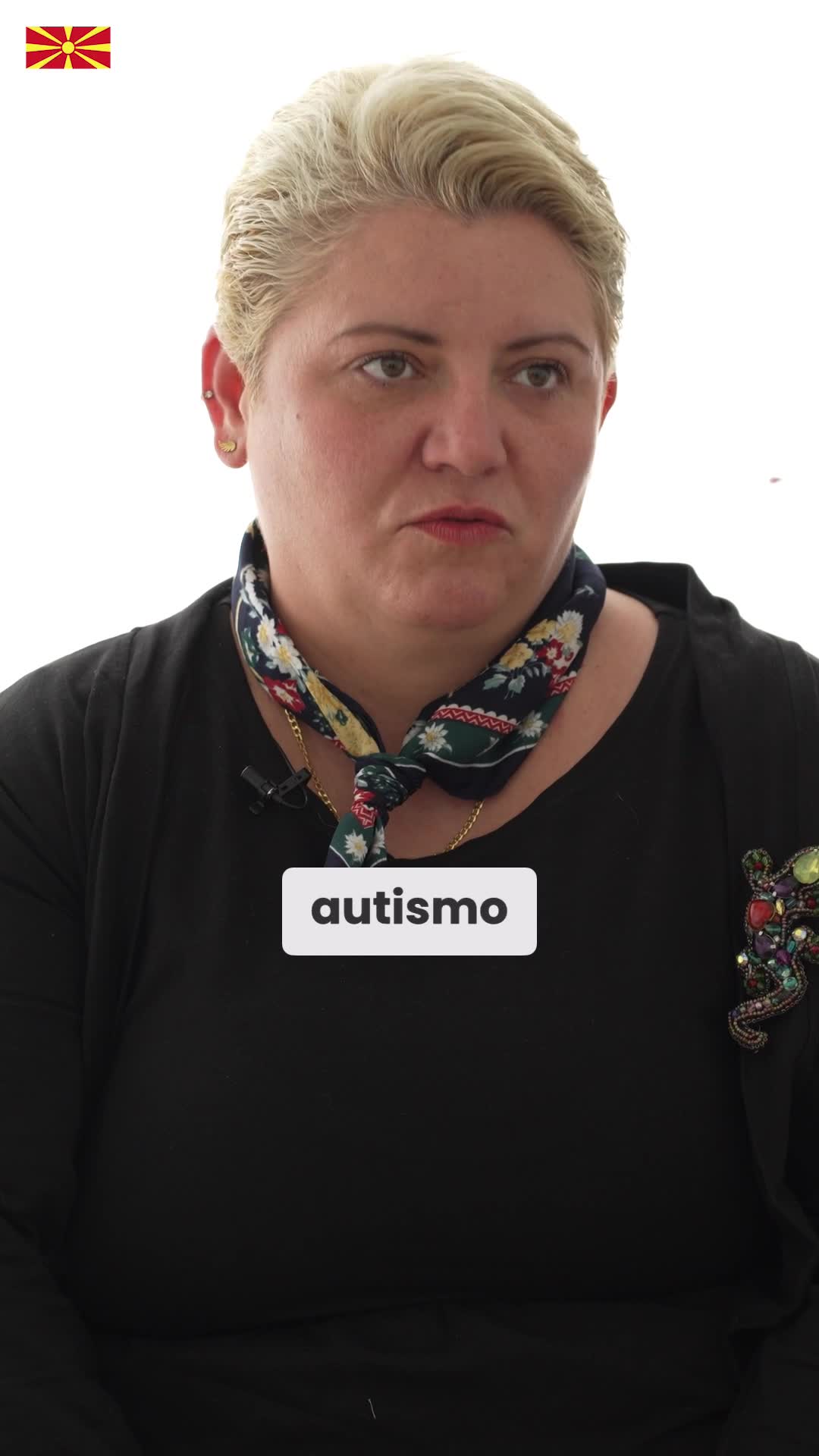 Autismo y terapia con células madre: ¿puede ser posible la transformación?