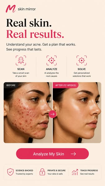 Why Does Your Acne Keep Coming Back?