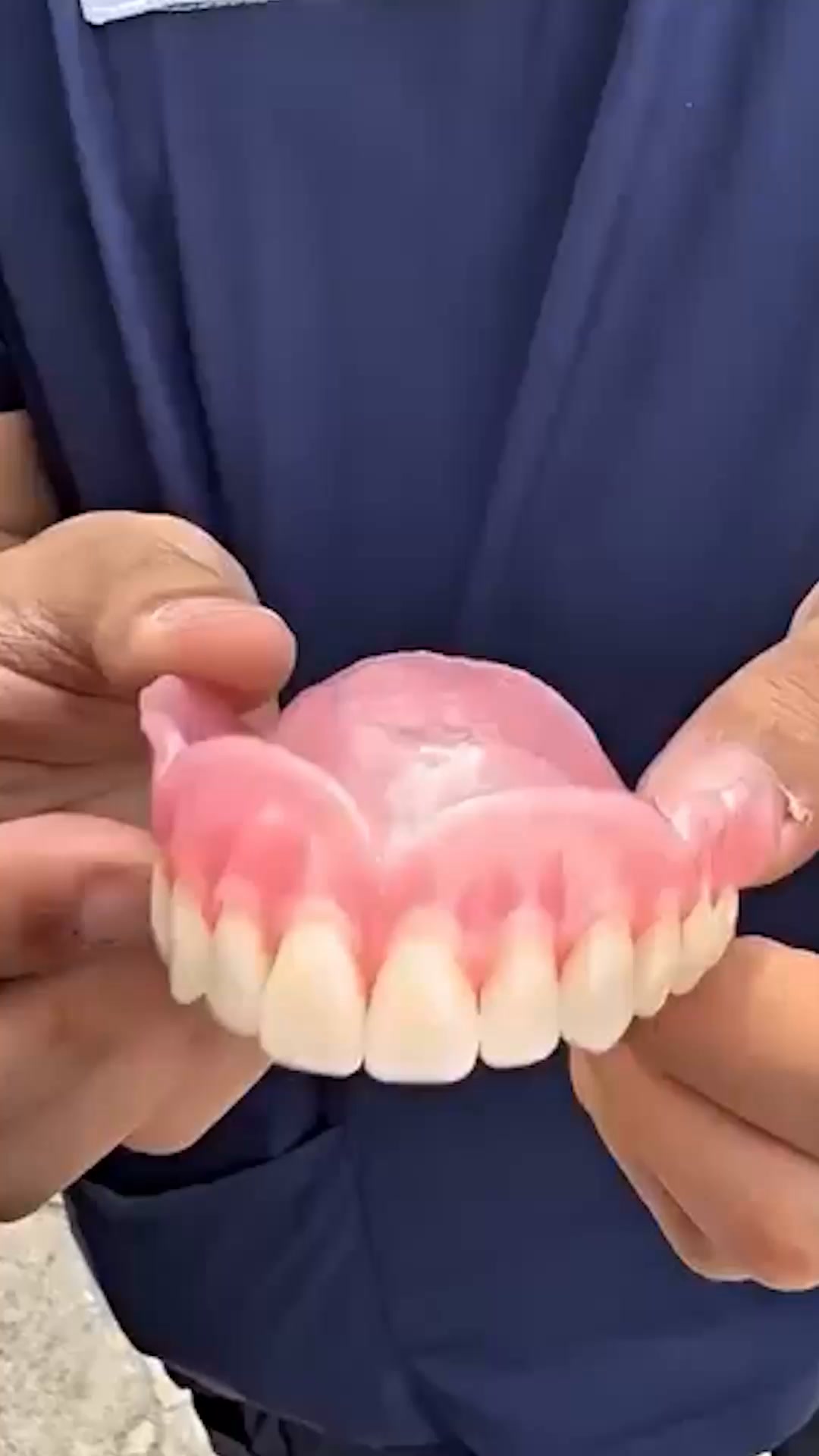 Un sourire naturel instantanément!