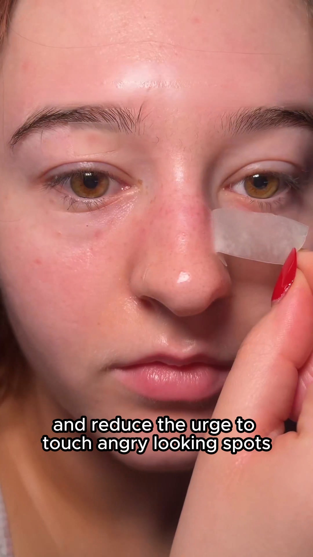 Irish Weather Is Back. So Are The Breakouts.