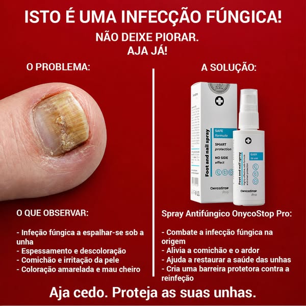 Fungos. Não ignore.