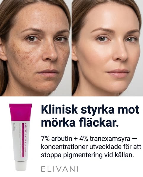 Upp till 80% rabatt + fri frakt – endast idag!