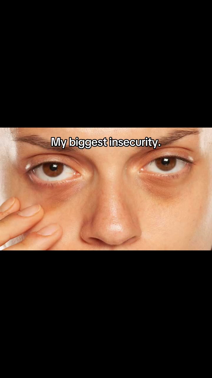 Your Skin Isn't Dry. It's Deflated.