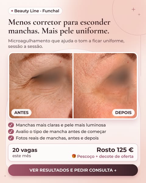 Vê os resultados reais no site