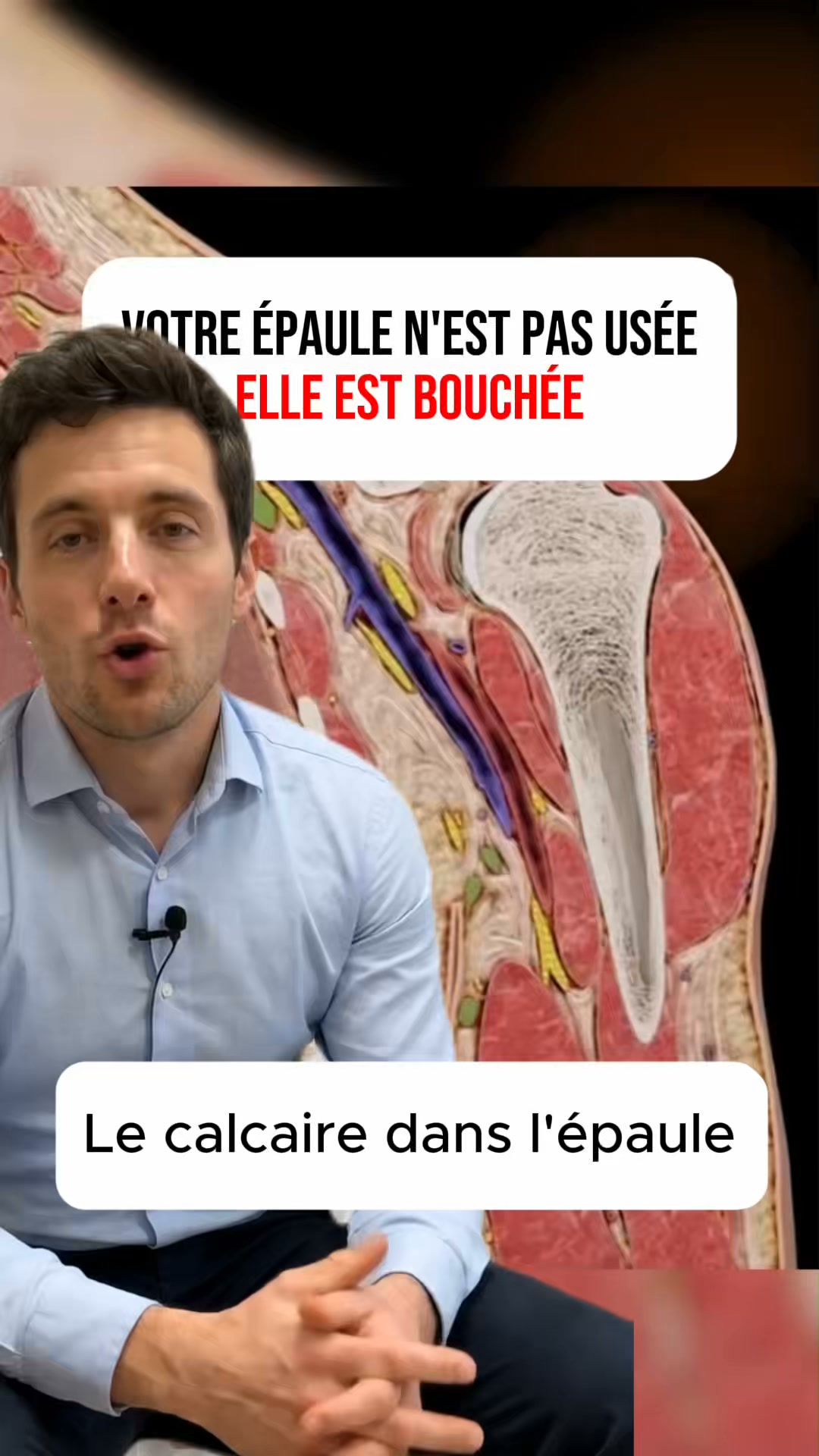 En chirurgie, on l'appelle la zone critique