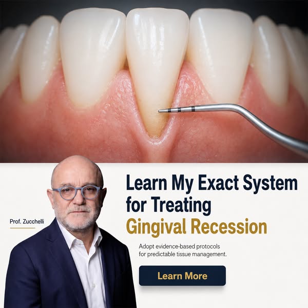 Zucchelli Channel — Master Periodontal Surgery
