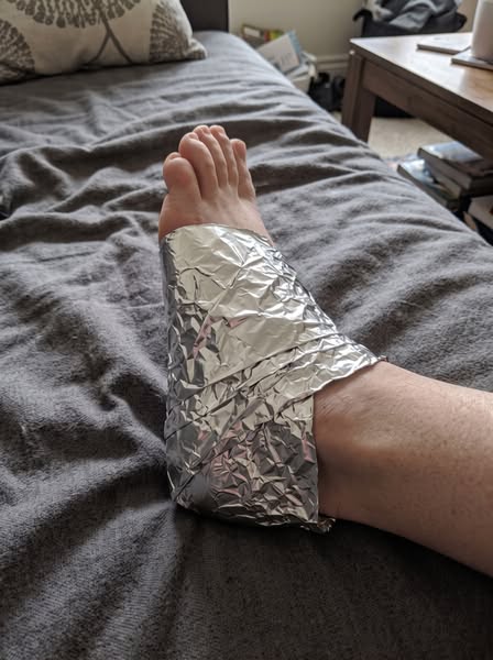 Därför läker inte din plantar fasciit, och vad som faktiskt hjälper