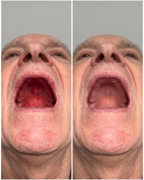 Lisez ceci si vous portez un dentier