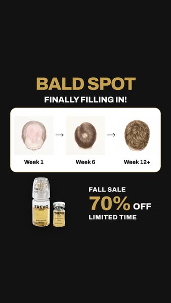 Up to 70% Off + Extra 10% Today