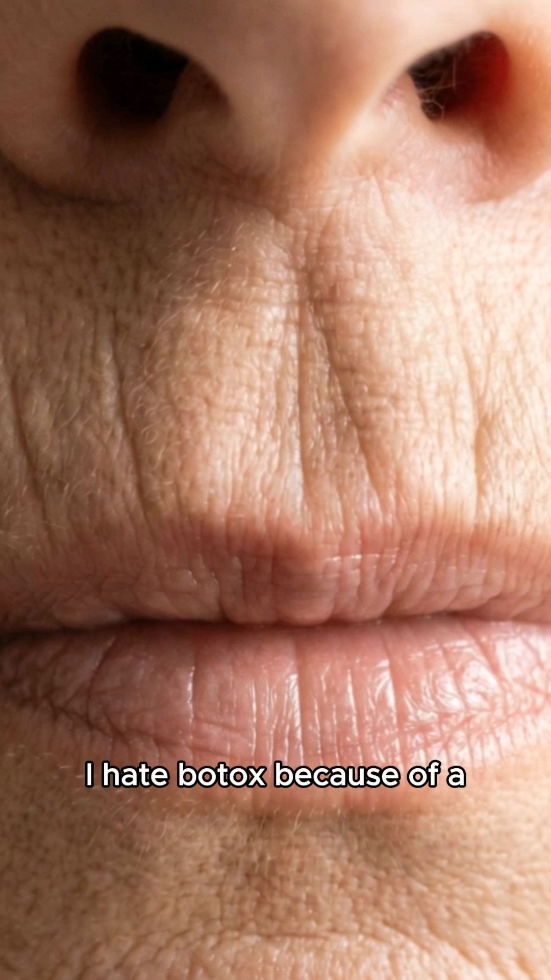 Stop using anti-aging product for lip lines