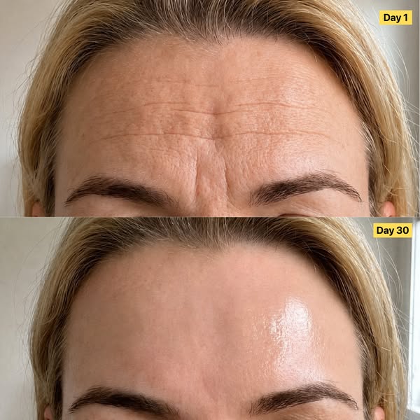"My skin came back to life!"