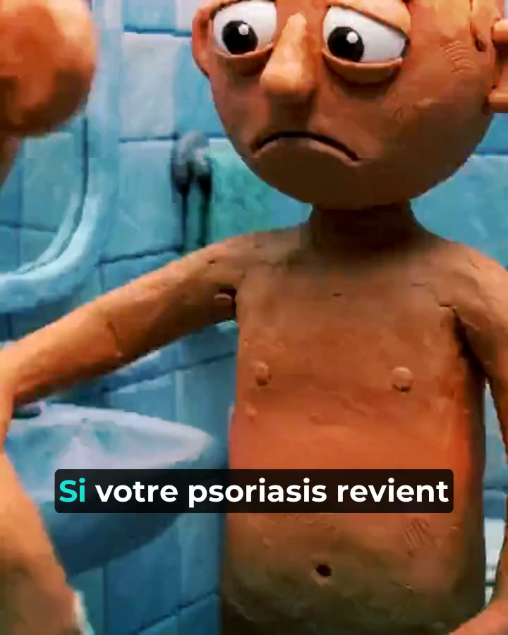 Ta crème actuelle vs Psorelia