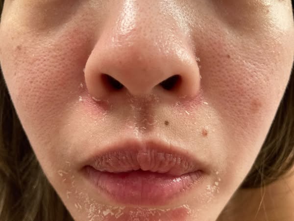 Read this if your skin is betraying you.
