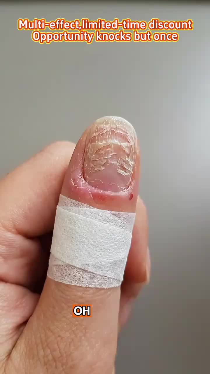 Professional Nail Treatment Bottle