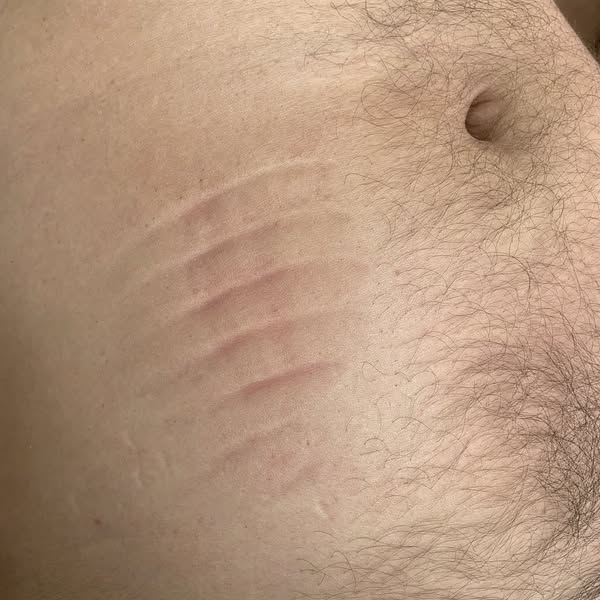 Support drainage and feel lighter every day.