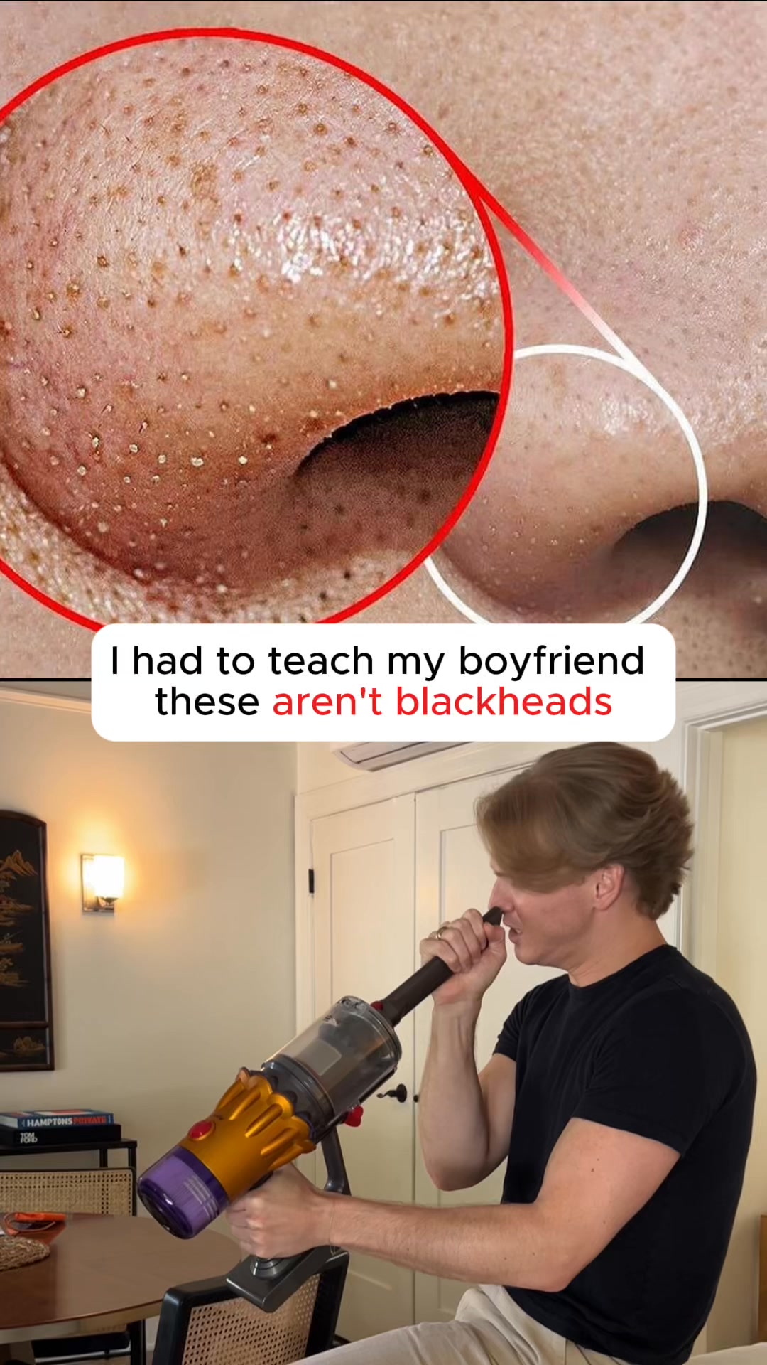 No More Nose Bumps