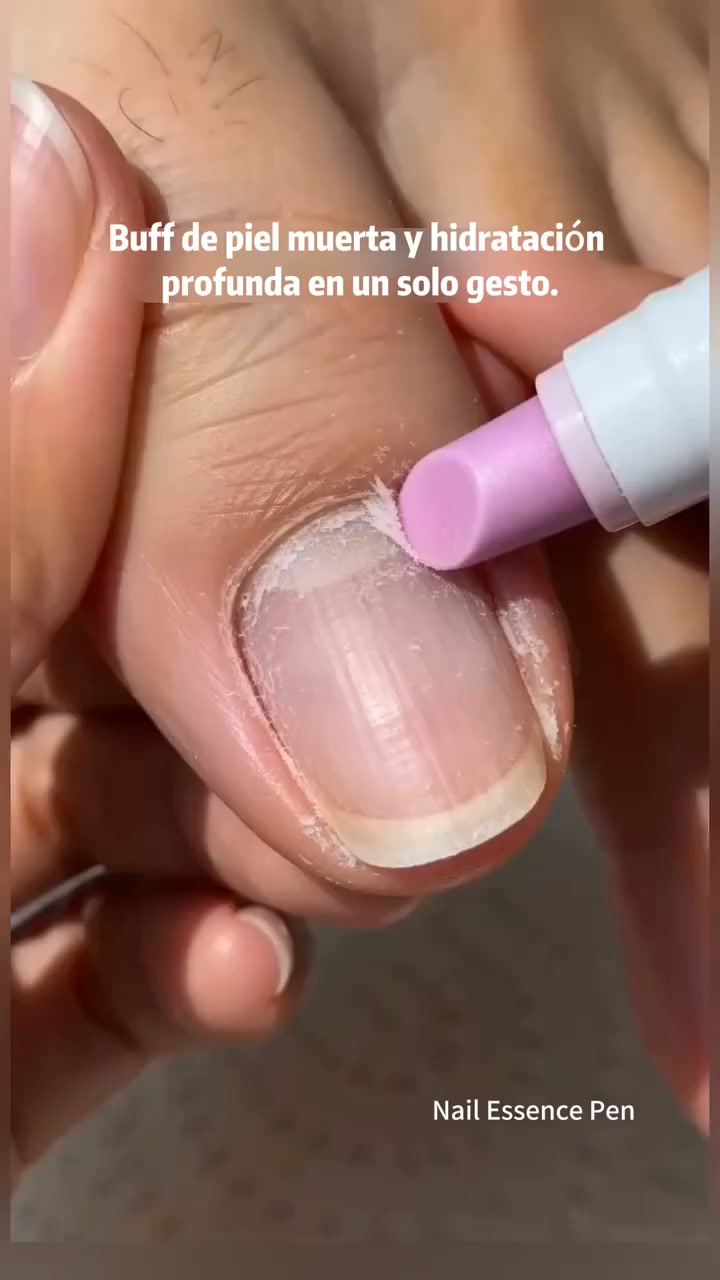 LAST DAY! BUY 1 GET 1 FREE | Just £6.99 onlyPortable Nail Care Essence Pen – Precise Cuticle Moisturizing Treatment, Smooth Applicator T