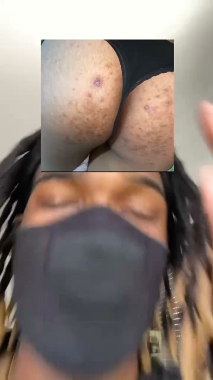 Révélez une peau plus lisse et éclatante