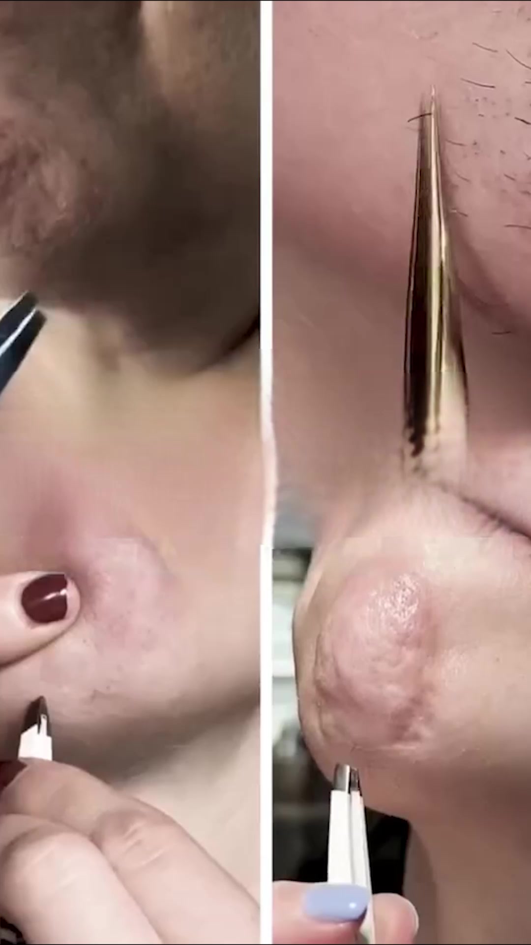 ENFIN un visage sans irritation !