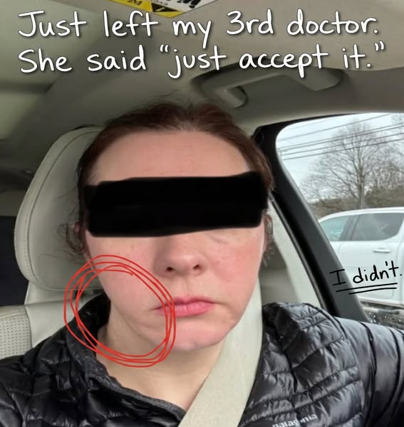 My answer for the saggy skin Ozempic left behind + my husband finally noticing my face again
