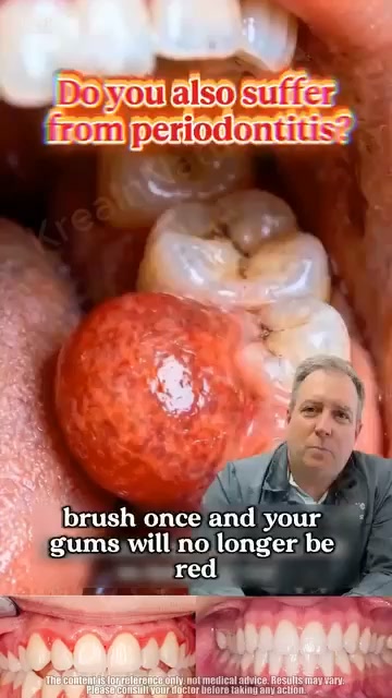 Top Dentists Are Begging You To Try This! (Buy 1 Get 1 FREE Today)