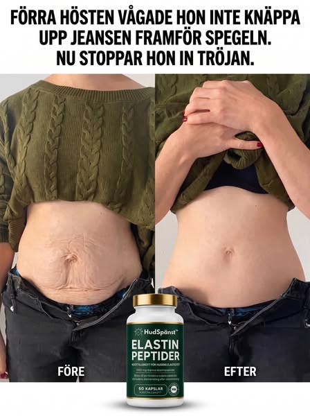 Slapp Hud? Det Är Inte Vikten. Det Är Elastinet
