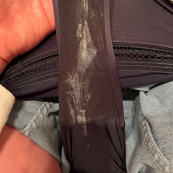 Meine Lösung bei wiederkehrender BV - und mein Selbstbewusstsein zurück