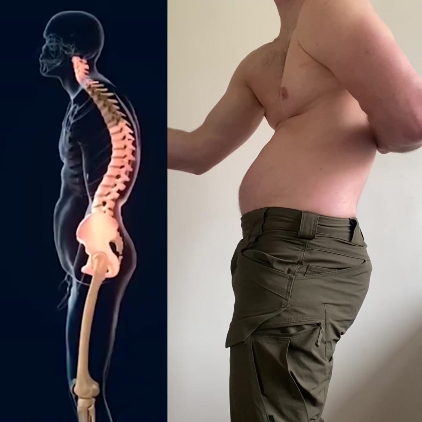 LumbarLock 30% Off + FREE Shipping!
